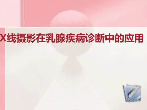 X线摄影在乳腺疾病诊断中的应用ppt课件