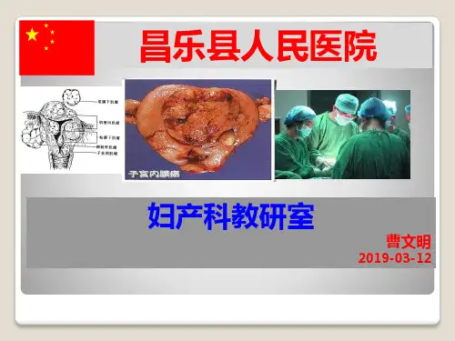 子宫肌瘤教学查房,2019-3