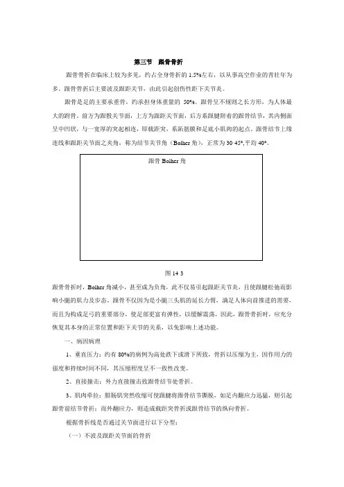 跟骨骨折