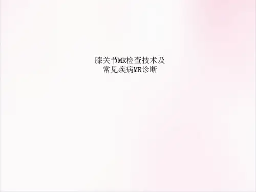 膝关节MR检查技术及常见疾病MR诊断医学课件