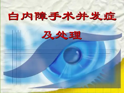 白内障手术并发症及处理【104页】