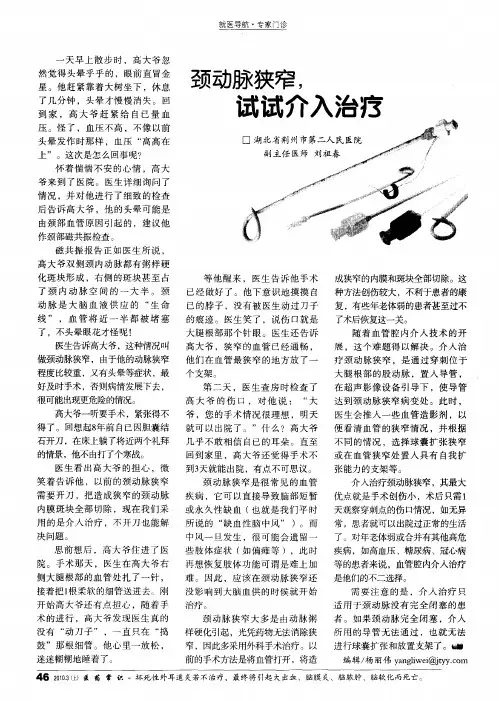颈动脉狭窄,试试介入治疗
