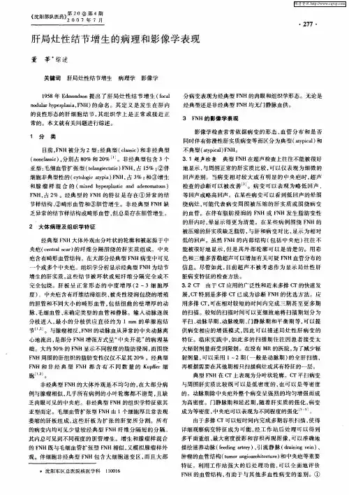 肝局灶性结节增生的病理和影像学表现