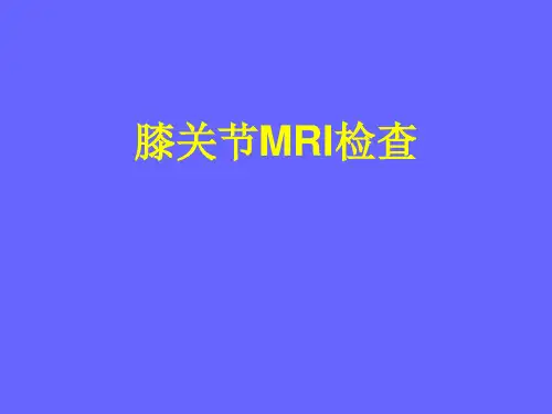 膝关节MRI与解剖 PPT课件