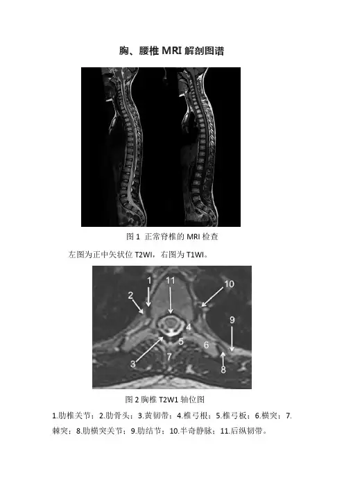 胸椎、腰椎MRI解剖图谱