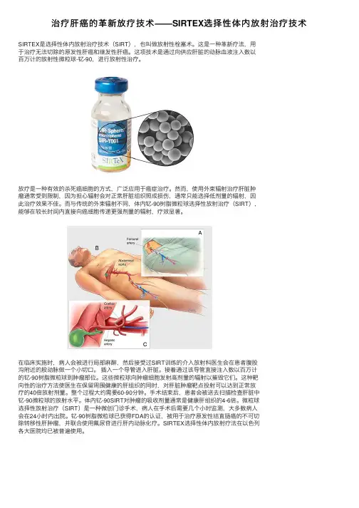 治疗肝癌的革新放疗技术——SIRTEX选择性体内放射治疗技术