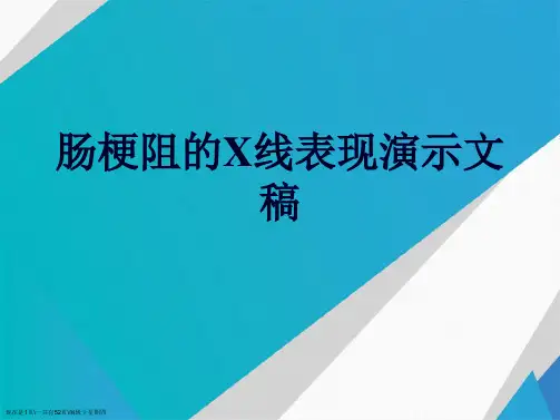 肠梗阻的X线表现演示文稿