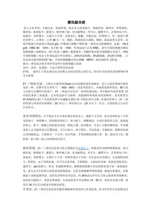 唐氏综合症
