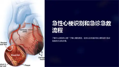 急性心梗识别和急诊急救流程课件