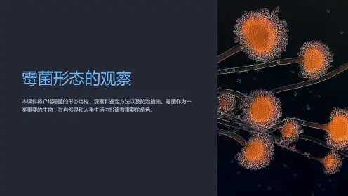 《霉菌形态的观察》课件
