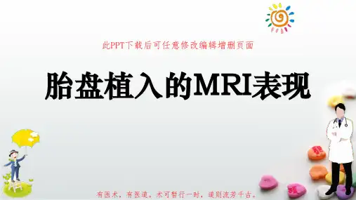 胎盘植入的MRI表现PPT成品
