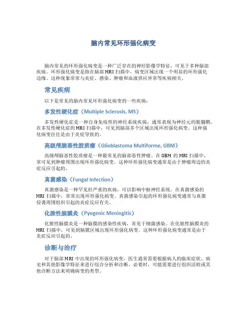 脑内常见环形强化病变
