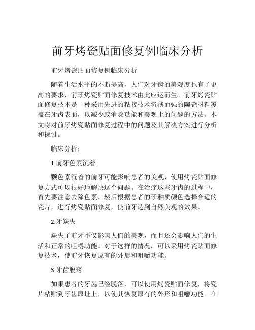 前牙烤瓷贴面修复例临床分析
