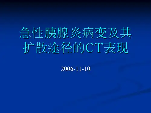 胰腺炎的影像学表现