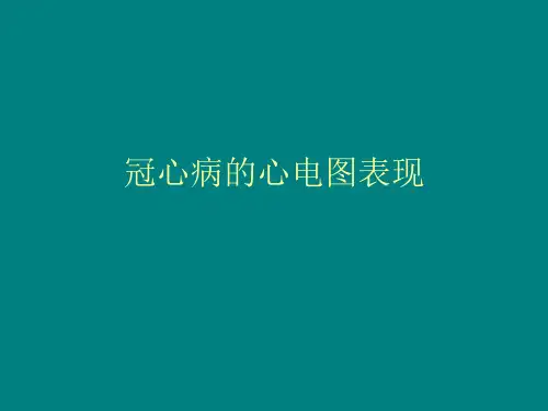 冠心病的心电图表现#