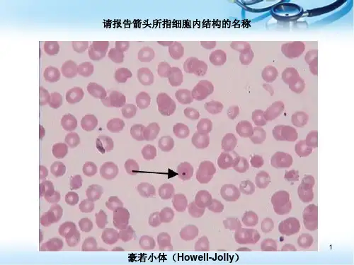 (医学课件)血涂片图谱