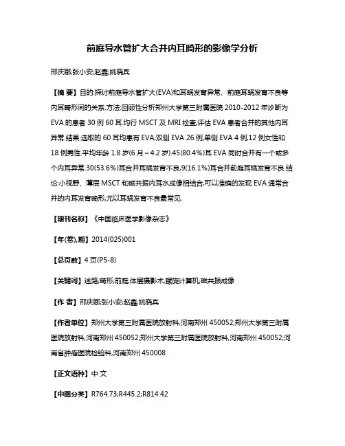 前庭导水管扩大合并内耳畸形的影像学分析