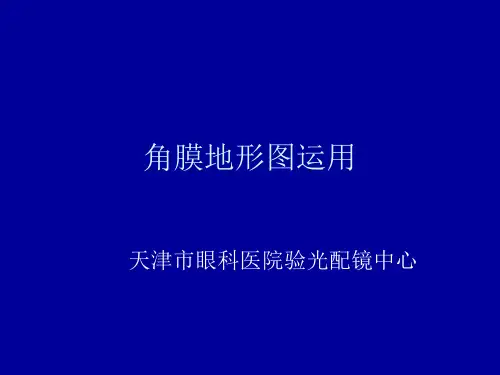 角膜地形图分析