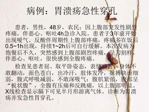 胃溃疡急性穿孔