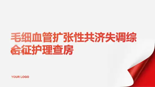 2024年毛细血管扩张性共济失调综合征护理查房PPT