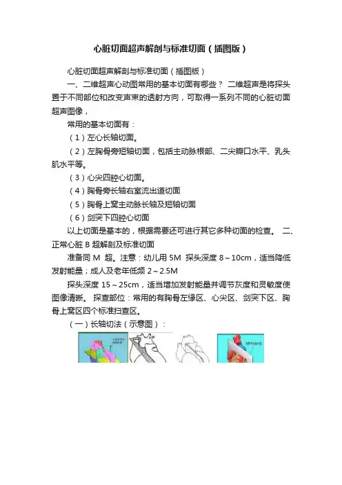 心脏切面超声解剖与标准切面（插图版）