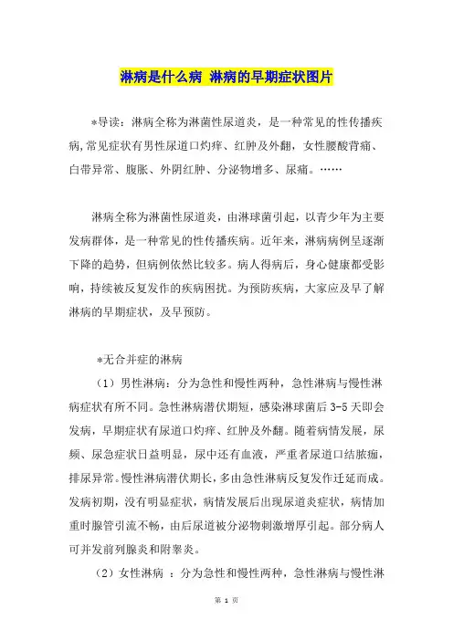 淋病是什么病 淋病的早期症状图片