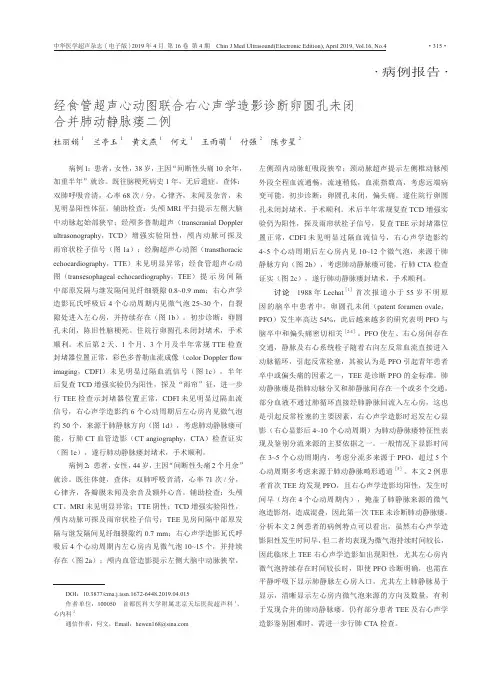 经食管超声心动图联合右心声学造影诊断卵圆孔未闭合并肺动静脉瘘二例