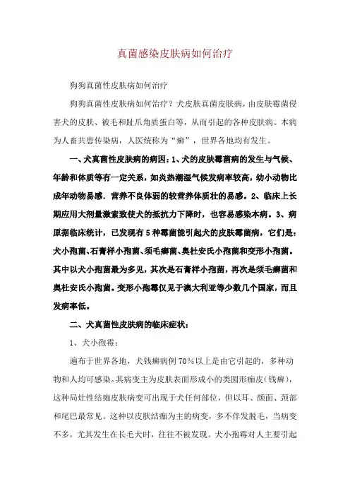 真菌感染皮肤病如何治疗