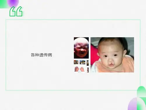遗传病和遗传病的预防
