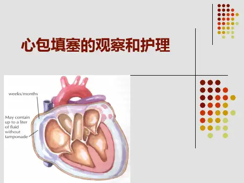 心包填塞的观察和护理 ppt课件