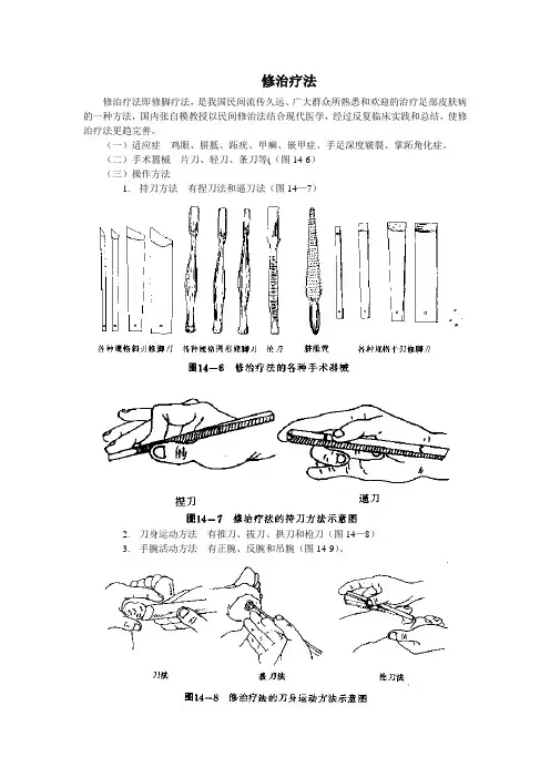修脚疗法