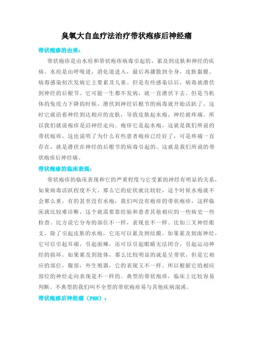 臭氧大自血疗法治疗带状疱疹后神经痛