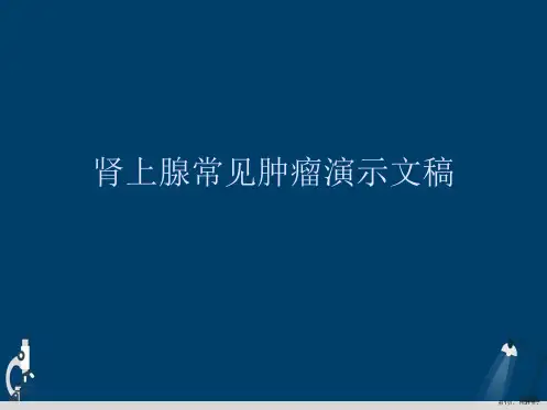 肾上腺常见肿瘤演示文稿