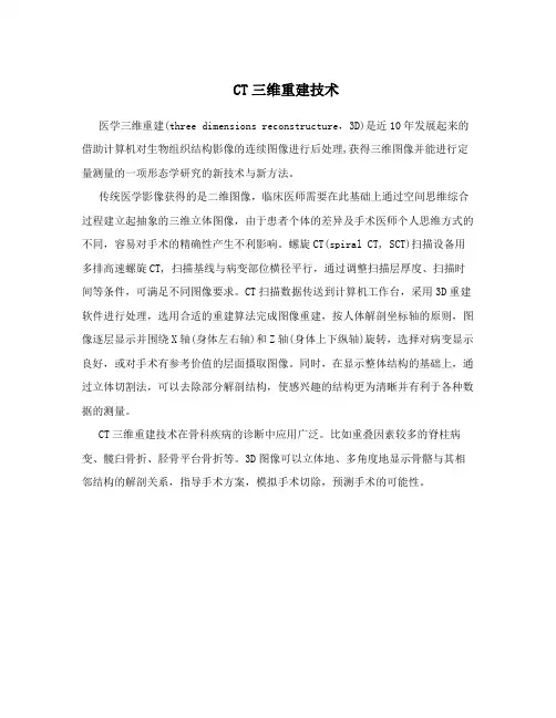CT三维重建技术