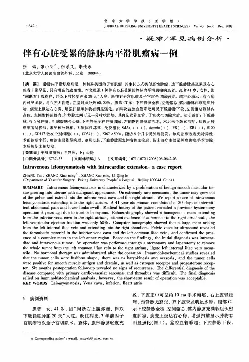 伴有心脏受累的静脉内平滑肌瘤病一例