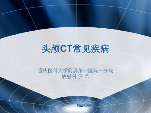 头颅CT常见疾病ppt课件