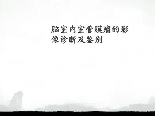 脑室内室管膜瘤的影像诊断及鉴别  ppt课件