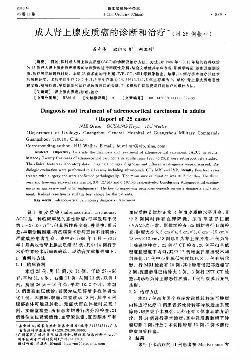 成人肾上腺皮质癌的诊断和治疗(附25例报告)