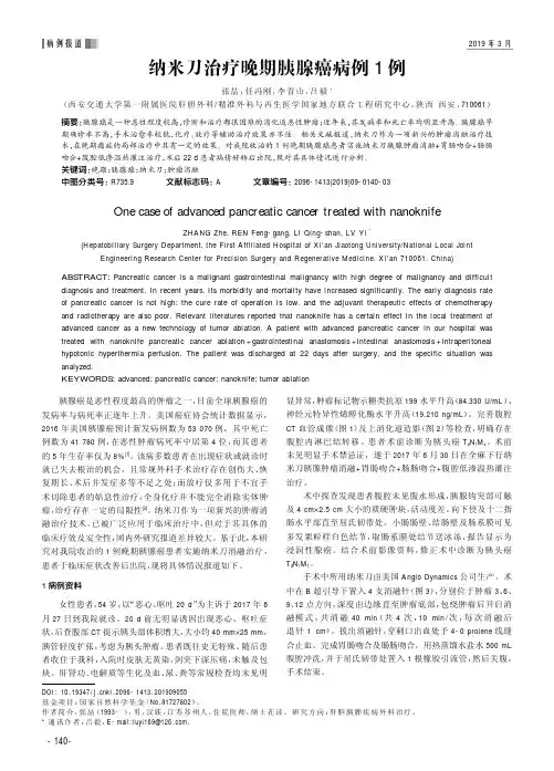 纳米刀治疗晚期胰腺癌病例1例