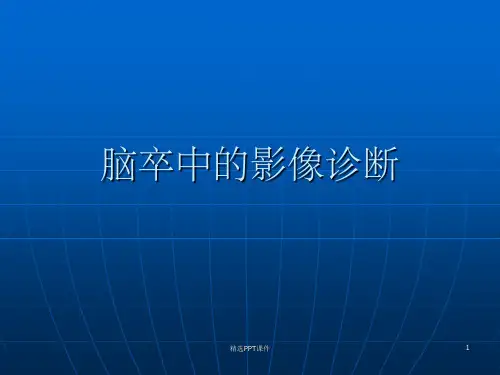 脑卒中的CT诊断ppt课件