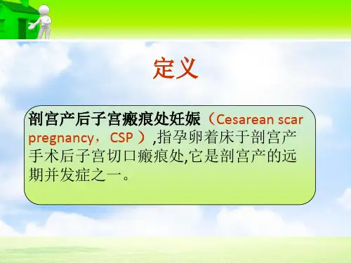 最新培训资料护理查房切口妊娠ppt课件