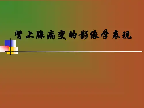 肾上腺肿瘤性病变的影像表现