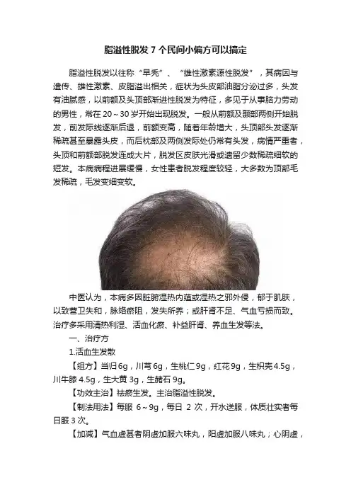 脂溢性脱发7个民间小偏方可以搞定