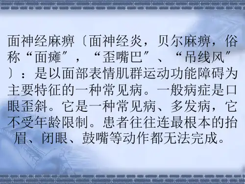 面瘫最新解析.ppt