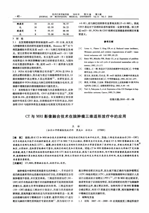 CT与MRI影像融合技术在脑肿瘤三维适形放疗中的应用