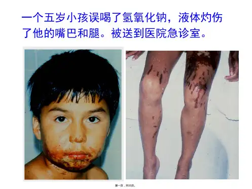 皮肤损伤修复经典讲座(附图和实例)