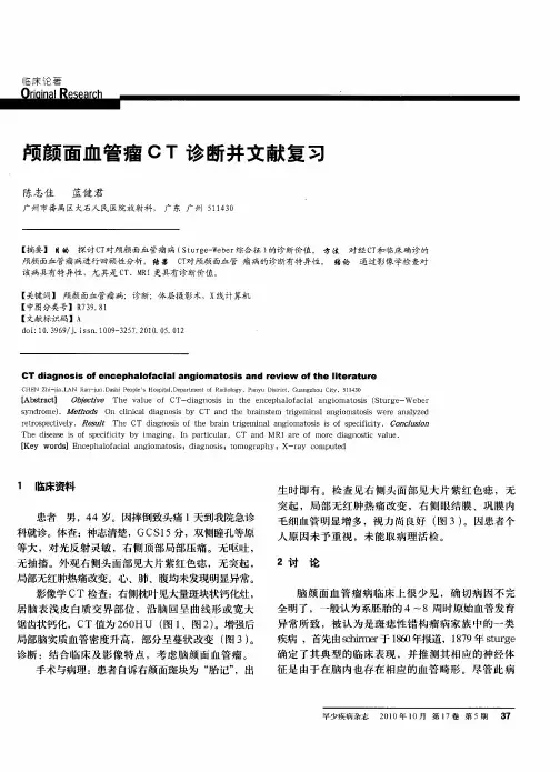 颅颜面血管瘤CT诊断并文献复习