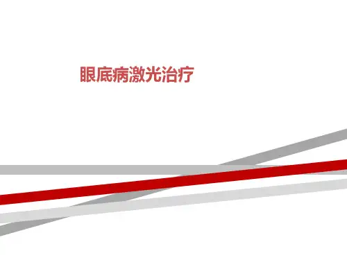 眼底病激光治疗