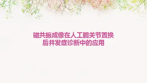 磁共振成像在人工髋关节置换后并发症诊断中的应用