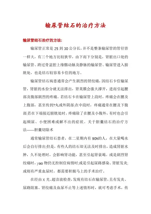 输尿管结石的治疗方法